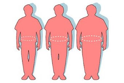 Clínica San Agustín proceso de disminución de peso 