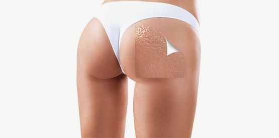 Glúteos de mujer